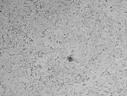 Human TLR8 Knockout Cell Line-HAP1